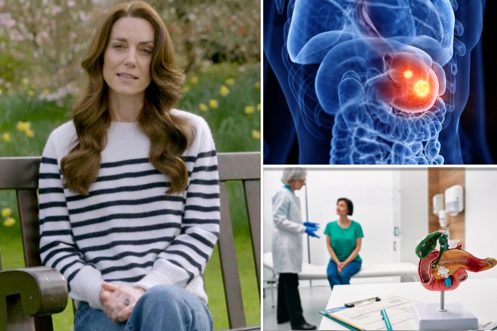 O diagnóstico de Kate Middleton ocorre em meio a uma “epidemia” de câncer precoce